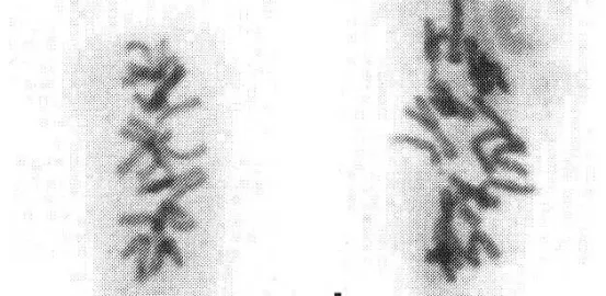 chromosome 22