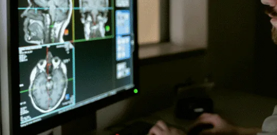 researcher studying a brain scan on a computer