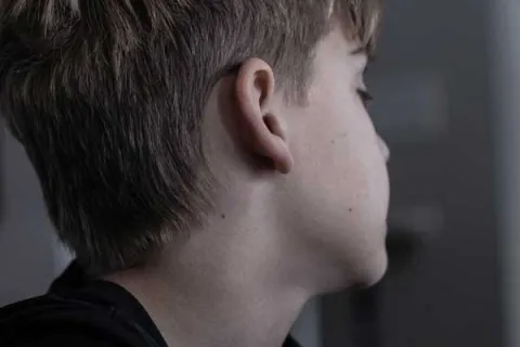 side of a young boys head